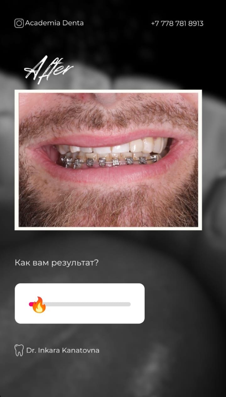 Кейс — результат