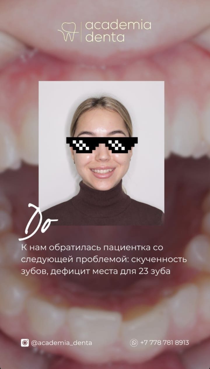 Кейс — до