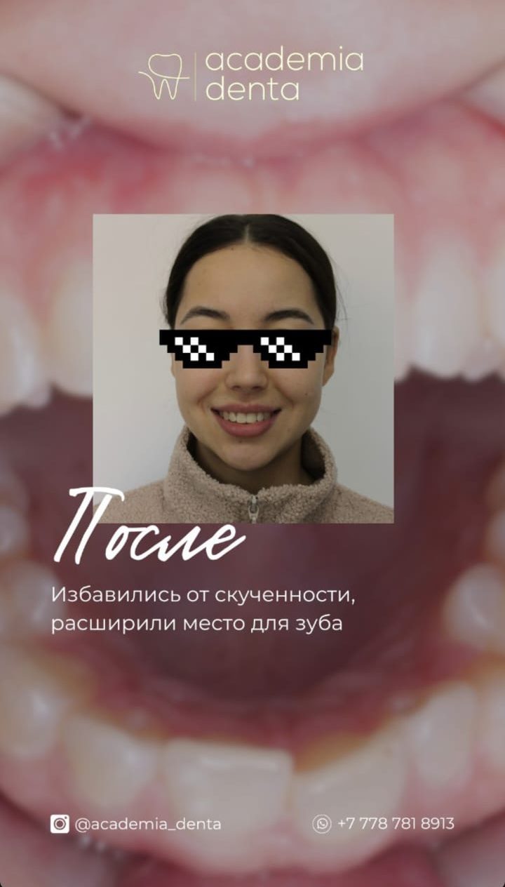 Кейс — после